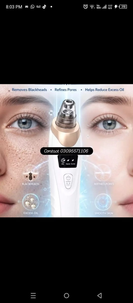 "Solvix™ Professional Pore Cleansing Blackhead Remover – Get Clear & Glowing Skin"
